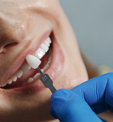 https://www.clinicdentuniversal.com/dental-treatments-in-turkey