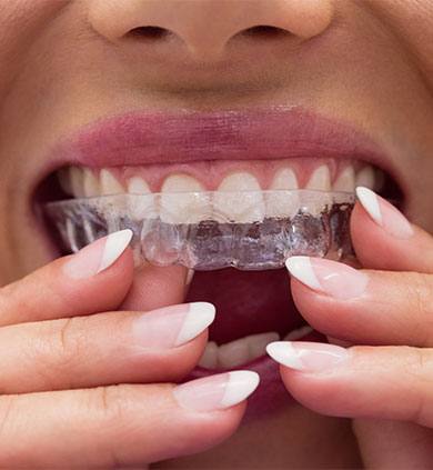 https://www.clinicdentuniversal.com/dental-treatments-in-turkey